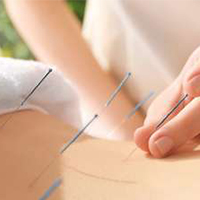 Bird Nest Acupuncture Therapy Clinic